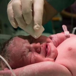 A newborn baby in hospital care, with a doctor's gloved hand at the baby's eyes